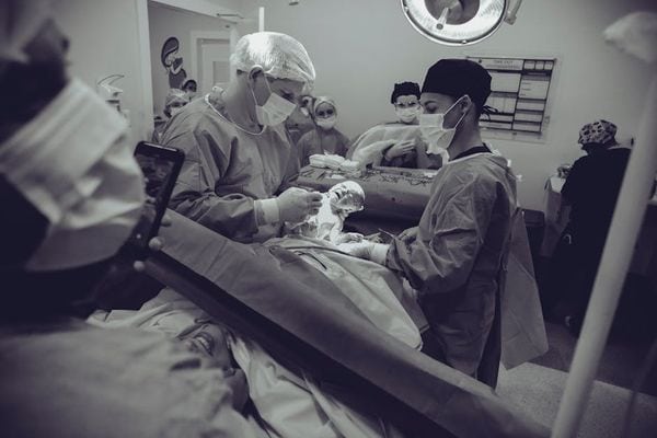 ניתוח לידה